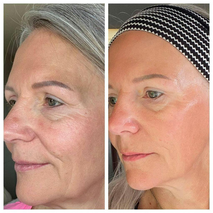 Masque au collagène Medicube